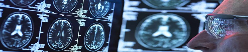 神經干細胞移植的過程 神經干細胞移植的過程