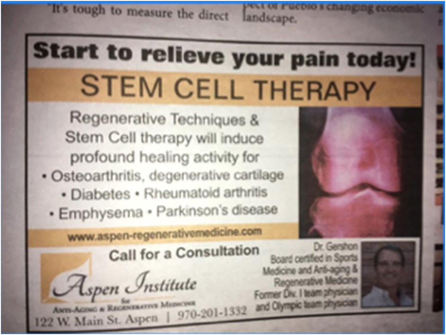 間充質(zhì)干細(xì)胞治療1型糖尿病臨床應(yīng)用案例