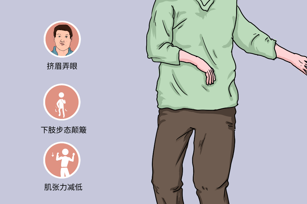 干細(xì)胞療法治療亨廷頓病的臨床前試驗進(jìn)展