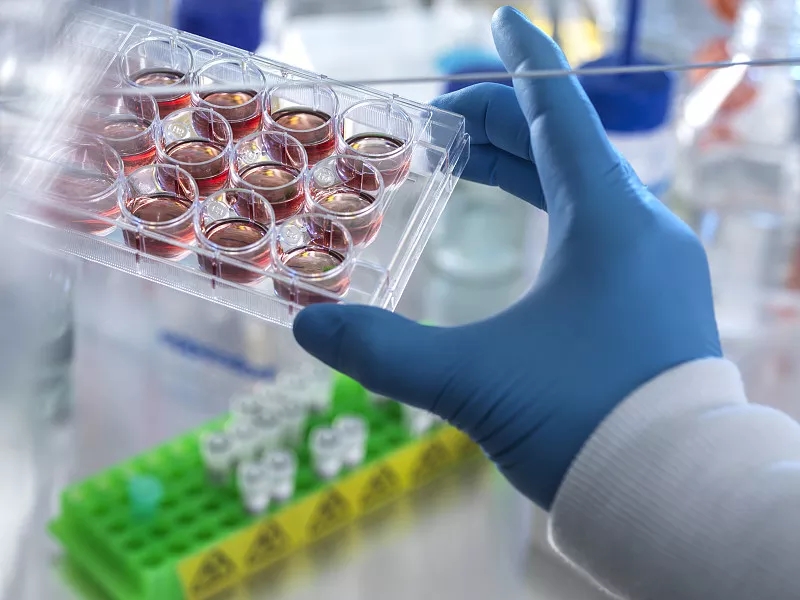 間充質干細胞治療阿爾茨海默病的臨床前研究