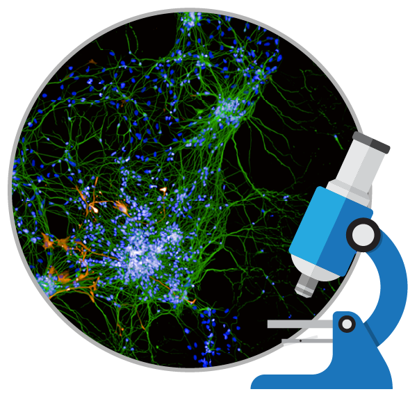 干細胞能治療好阿爾茨海默癥嗎？