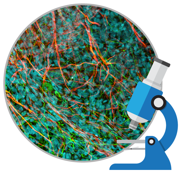 干細(xì)胞治療如何對(duì)自閉癥患者提供幫助?