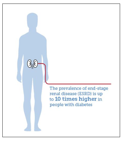 糖尿病并發癥腎病