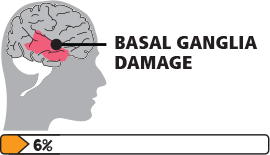 運動障礙腦癱-icon