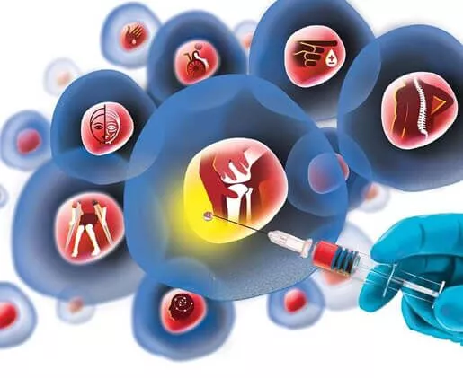 什么是干細胞療法 什么是干細胞療法