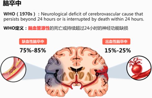 干細胞治療缺血性腦卒中的效果跟給藥途徑有關嗎 干細胞治療缺血性腦卒中的效果跟給藥途徑有關嗎