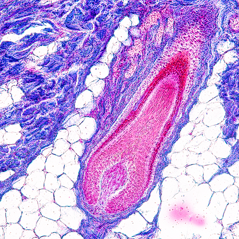 毛囊組織學(xué)觀察 毛囊組織學(xué)觀察