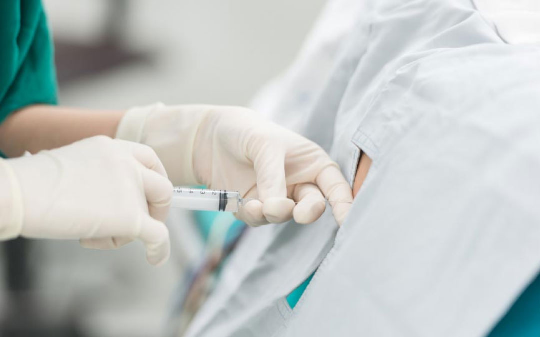 坐骨神經痛的干細胞療法 坐骨神經痛的干細胞療法