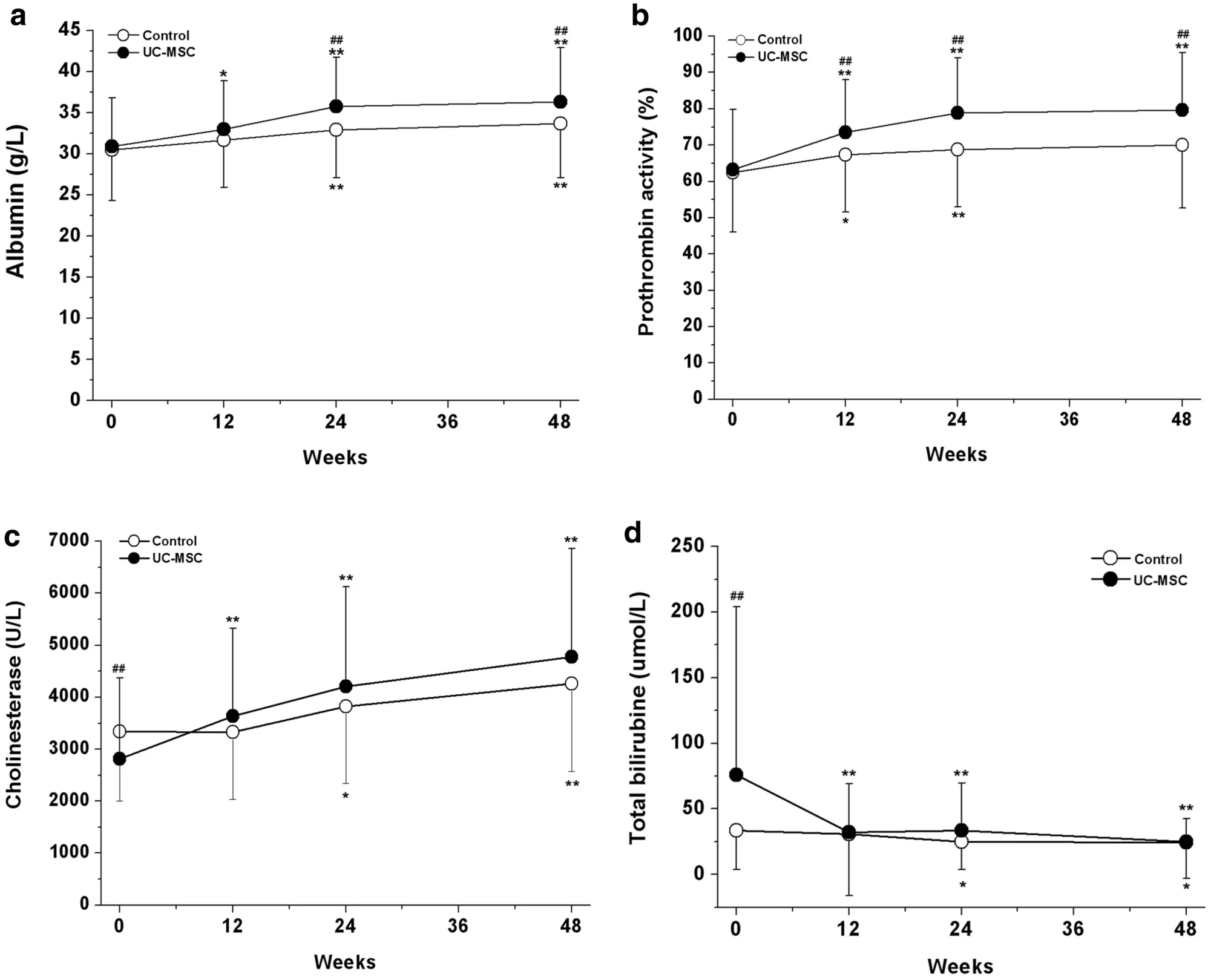 臍帶間充質(zhì)干細(xì)胞治療對(duì)失代償期肝硬化患者肝功能的影響 臍帶間充質(zhì)干細(xì)胞治療對(duì)失代償期肝硬化患者肝功能的影響