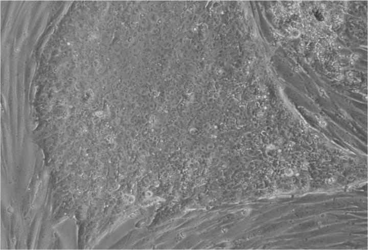 胚胎干細(xì)胞移植的來源 胚胎干細(xì)胞移植的來源