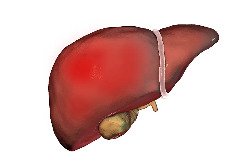什么是丁型肝炎？