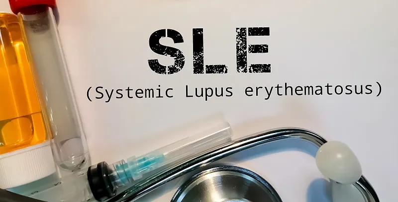 南京鼓樓醫(yī)院：干細胞治療在系統(tǒng)性紅斑狼瘡中維持長期治療效果