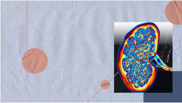 如何篩查糖尿病腎病-有哪些方法? 如何篩查糖尿病腎病-有哪些方法?
