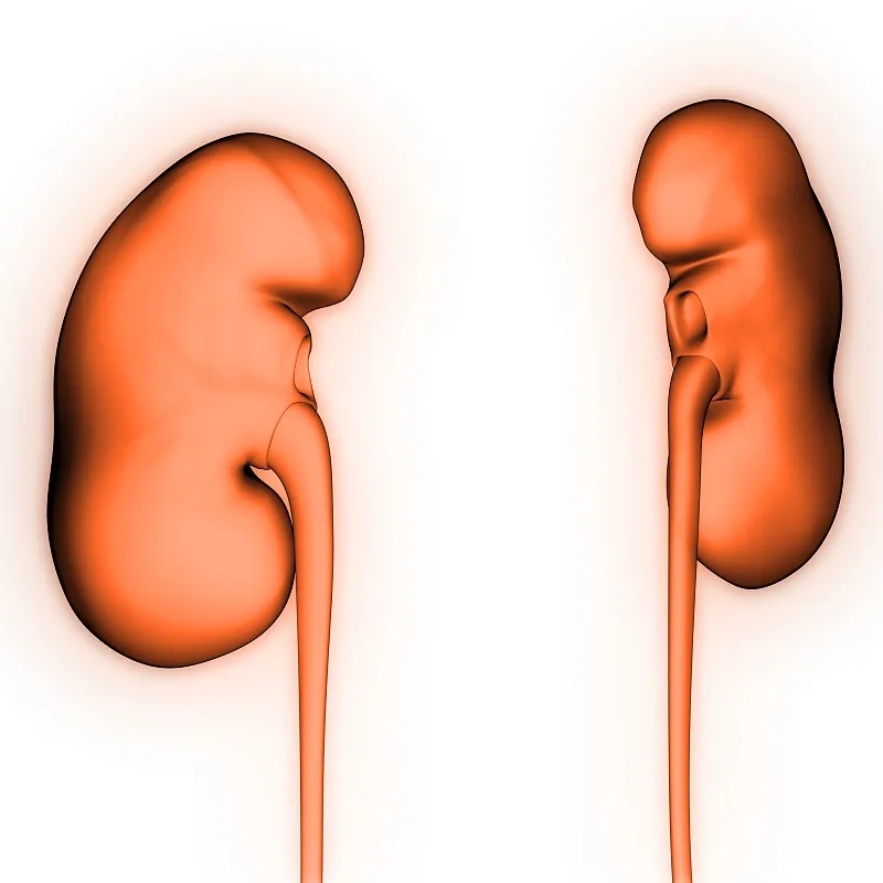 IgA腎?。喊Y狀-病因-診斷-飲食等