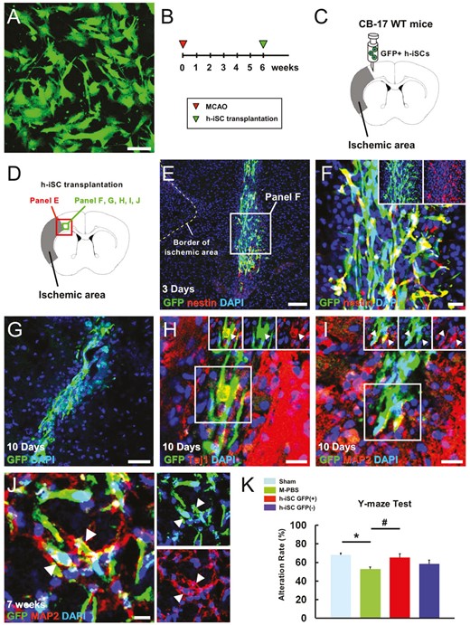 移植的h-iSC分化為成熟神經元，可能有助于MCAO后神經功能的恢復