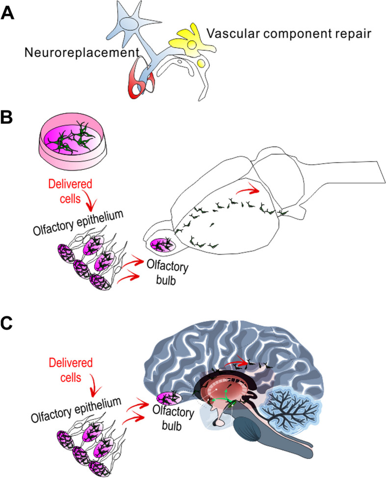 圖1：干細(xì)胞移植治療帕金森病的示意圖。