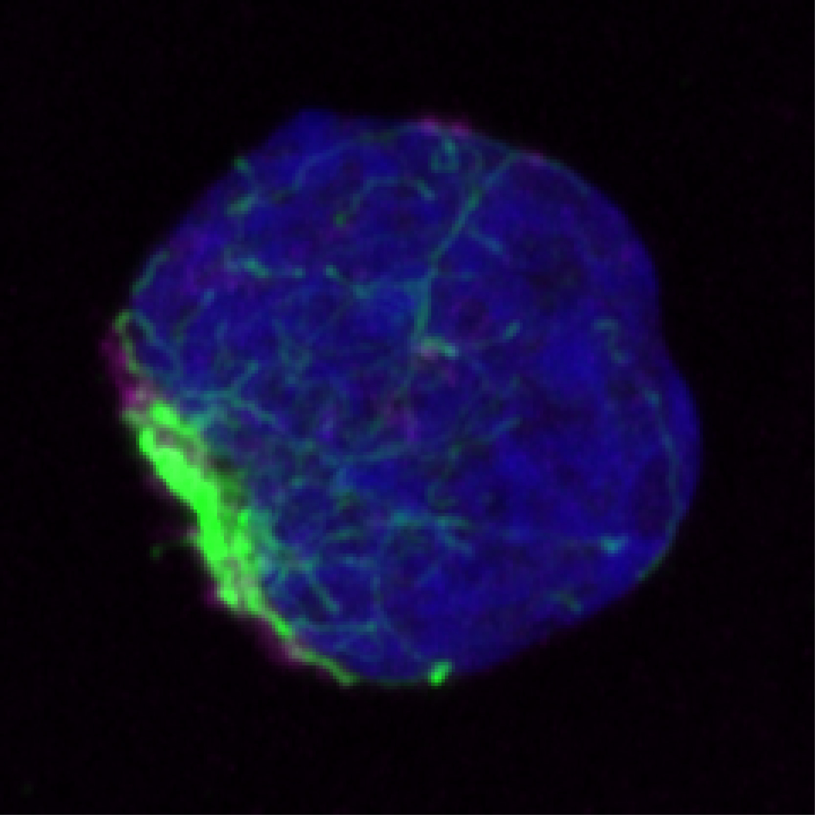 加州大學圣地亞哥分校的科學家發現，錯誤折疊的蛋白質在被處理之前聚集并被限制在干細胞內的單個區域（綠色）中。