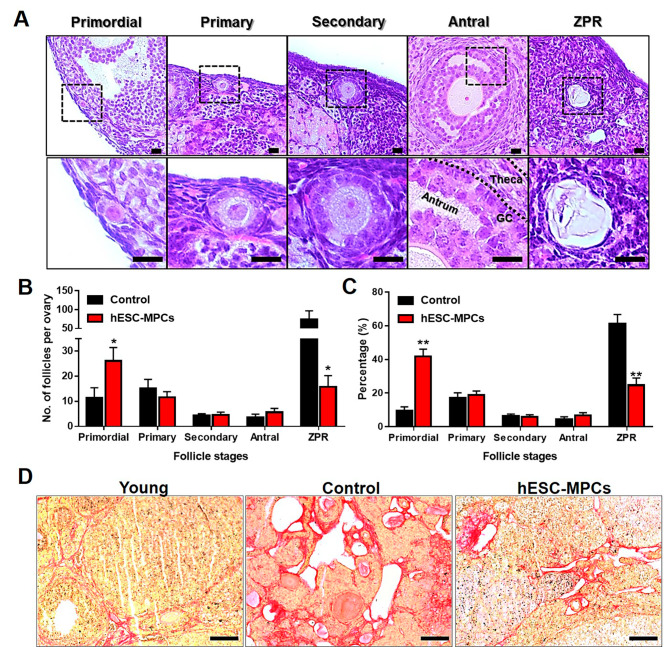 圖3：通過在圍絕經期小鼠中多次引入人胚胎干細胞衍生的間充質祖細胞（hESC-MPC）來維持卵巢儲備。