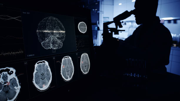神經系統疾病發病機制復雜，涉及基因突變、衰老過程等多種因素。