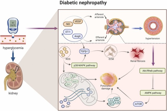 圖1:糖尿病腎病的病理信號。 圖1:糖尿病腎病的病理信號。