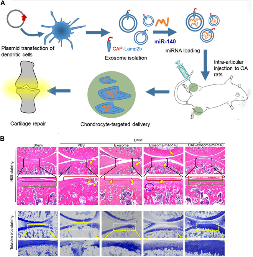 圖3：MSC-Exos藥物輸送用于OA治療的代表性研究。