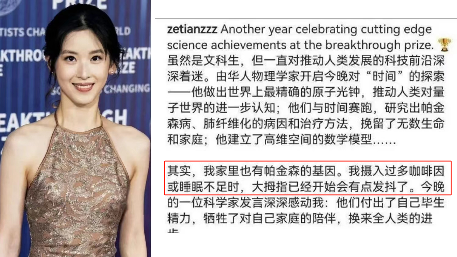 章澤天自曝有帕金森病家族史，干細(xì)胞療法讓年輕人不再懼“帕”