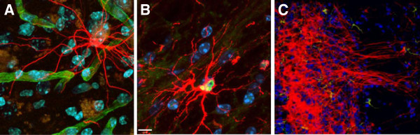 圖3：人類中樞神經(jīng)系統(tǒng)干細(xì)胞 (HuCNS-SC) 根據(jù)其遷移位點(diǎn)優(yōu)先分化為特定譜系。