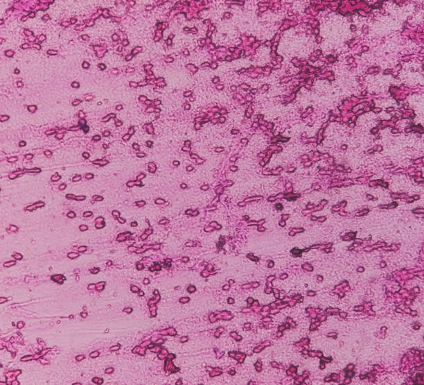 人羊膜上皮細(xì)胞對(duì)中樞神經(jīng)系統(tǒng)損傷和疾病的治療潛力 人羊膜上皮細(xì)胞對(duì)中樞神經(jīng)系統(tǒng)損傷和疾病的治療潛力