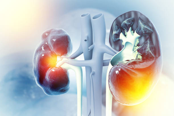 內(nèi)源性急性腎損傷治療