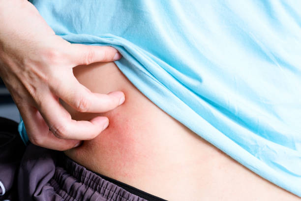 肝硬化肝腎綜合征的診斷、預(yù)防和治療