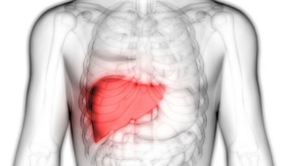 面對肝衰竭，你知道如何選擇最佳治療方案嗎？