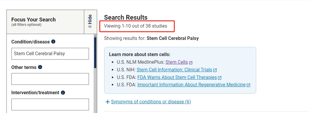clinicaltrials.gov網站上注冊的有關干細胞治療腦癱的臨床研究項目有38項。其中已完成的有12項。 clinicaltrials.gov網站上注冊的有關干細胞治療腦癱的臨床研究項目有38項。其中已完成的有12項。