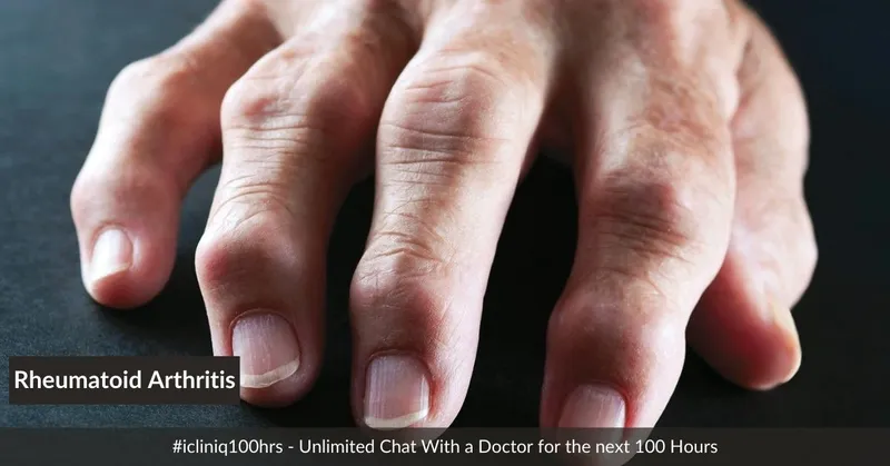 類風濕關節(jié)炎的體征和癥狀是什么？及其治療方法