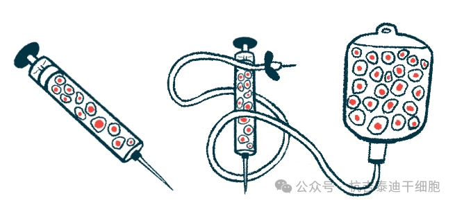 帕金森今日新聞:研究表明,低劑量TED-A9細胞療法可緩解帕金森病的運動癥狀 帕金森今日新聞:研究表明,低劑量TED-A9細胞療法可緩解帕金森病的運動癥狀
