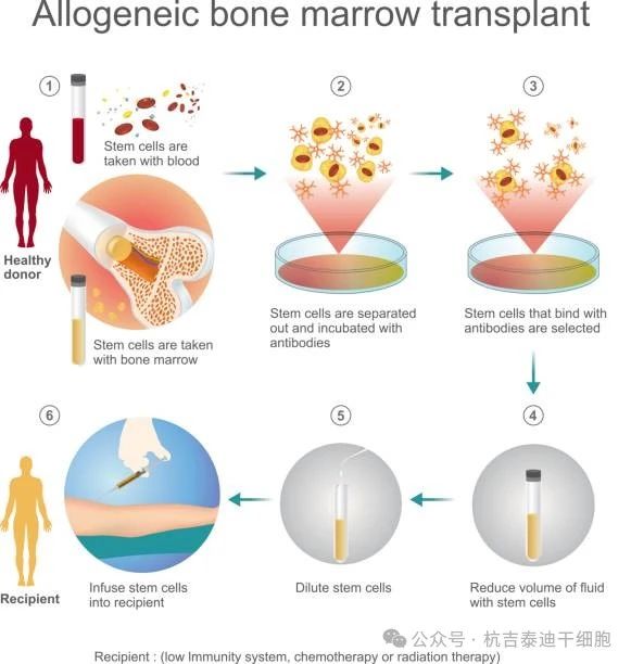 干細胞移植治療需要多長時間？