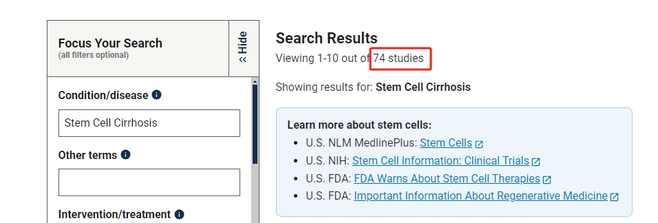 干細胞治療肝硬化的臨床研究進展