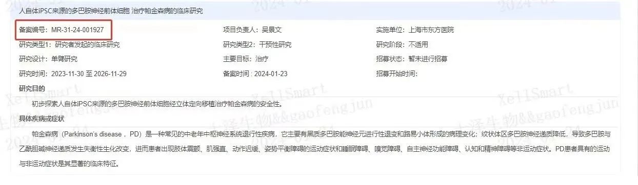 臨床級iPSC衍生多巴胺能神經前體細胞治療帕金森病的臨床研究
