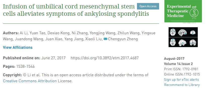 輸注臍帶間充質干細胞可緩解強直性脊柱炎癥狀 輸注臍帶間充質干細胞可緩解強直性脊柱炎癥狀