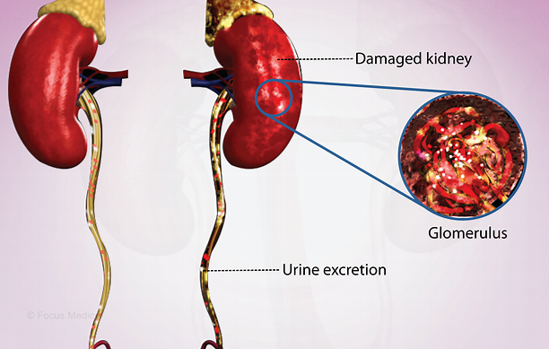近10年國內進行干細胞治療急性腎損傷臨床研究的醫院有哪些? 近10年國內進行干細胞治療急性腎損傷臨床研究的醫院有哪些?