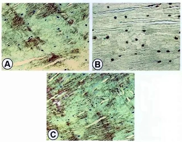 A為紅-紅區修復組織II型膠原的表達；B為紅-紅區修復組織S-100蛋白表達；C為紅-紅區修復組織I型膠原表達。