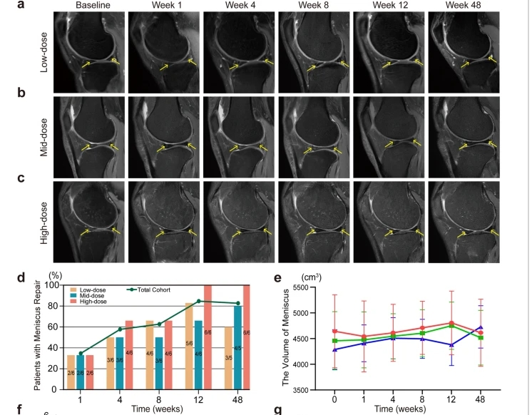 a – c不同劑量組膝關節 MRI 掃描中的半月板損傷。d半月板修復患者百分比。e注射后六個時間點的半月板體積分析。