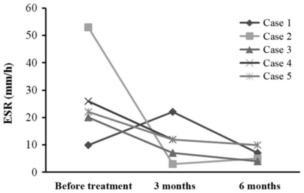 每位患者治療前后的 ESR。3 位患者的 ESR 明顯下降。ESR，紅細胞沉降率。