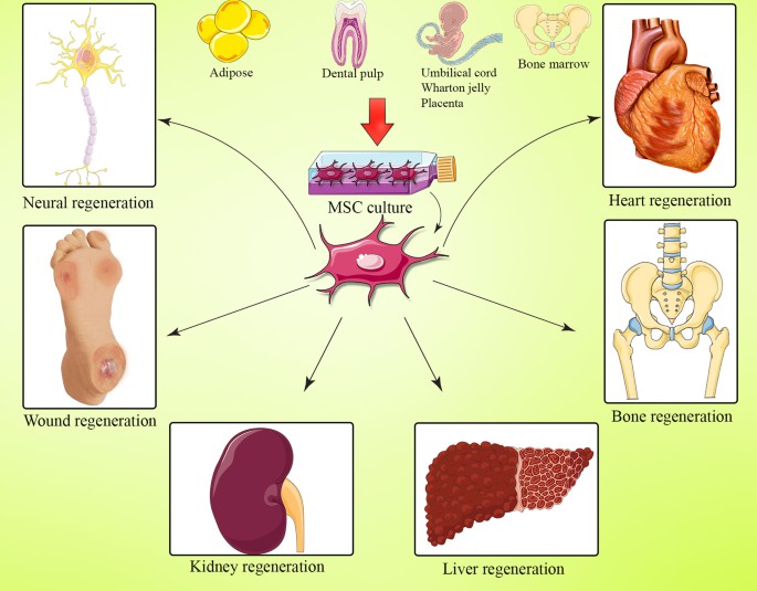 間充質干細胞(MSC) 是一種多能細胞，可分化為基質譜系細胞。間充質干細胞(MSC) 是骨髓 (BM-MSC)、脂肪組織、肝臟、羊水、胚胎胎盤、臍帶血和其他組織中的一組非造血細胞。骨髓間充質干細胞能夠抑制與GVHD病理生理學有關的大多數免疫細胞的激活和功能。