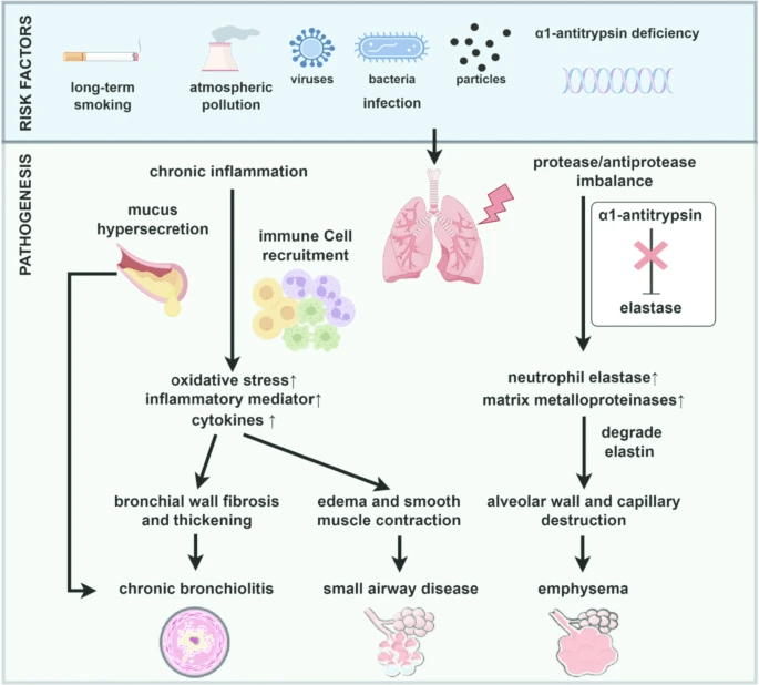 圖1:慢性阻塞性肺疾病的風(fēng)險因素和發(fā)病機(jī)制。 圖1:慢性阻塞性肺疾病的風(fēng)險因素和發(fā)病機(jī)制。