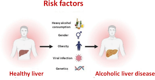 酒精性肝病風險因素
