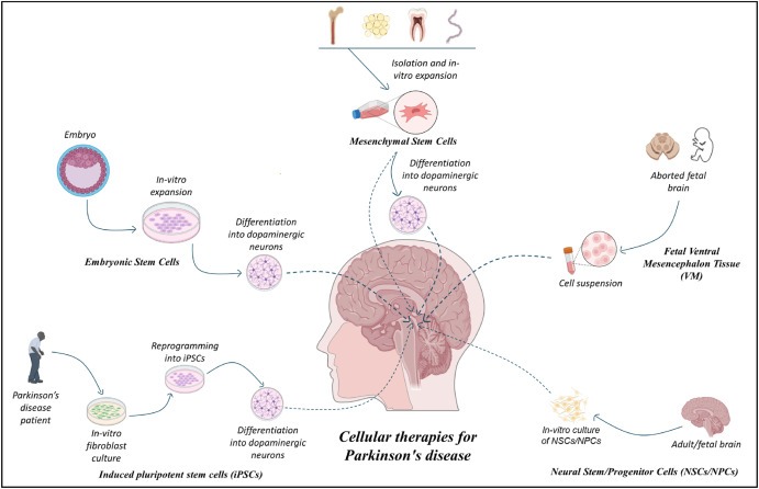 圖1：帕金森病的細胞療法：胚胎干細胞 (ESC)、誘導性多能干細胞 (iPSC)、間充質干細胞 (MSC)、神經干細胞/祖細胞 (NSC/NPS) 是帕金森病的新興候選藥物。