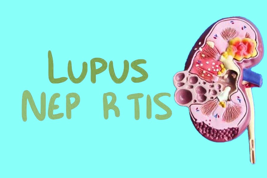 干細胞治療狼瘡性腎炎：2019-2024年臨床研究進展回顧