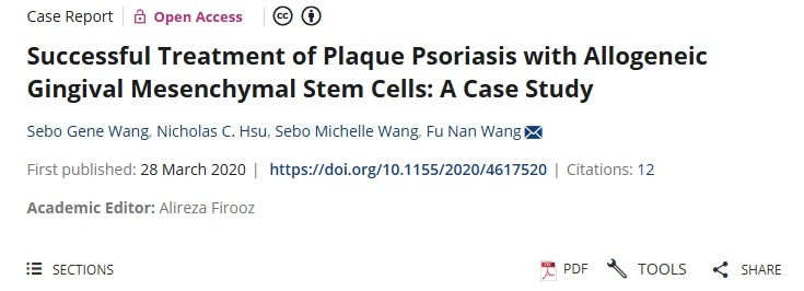 用同種異體牙齦間充質干細胞成功治療斑塊狀銀屑病：案例研究