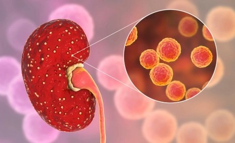 干細胞治療狼瘡性腎炎的安全性怎么樣？盤點國內外臨床進展！