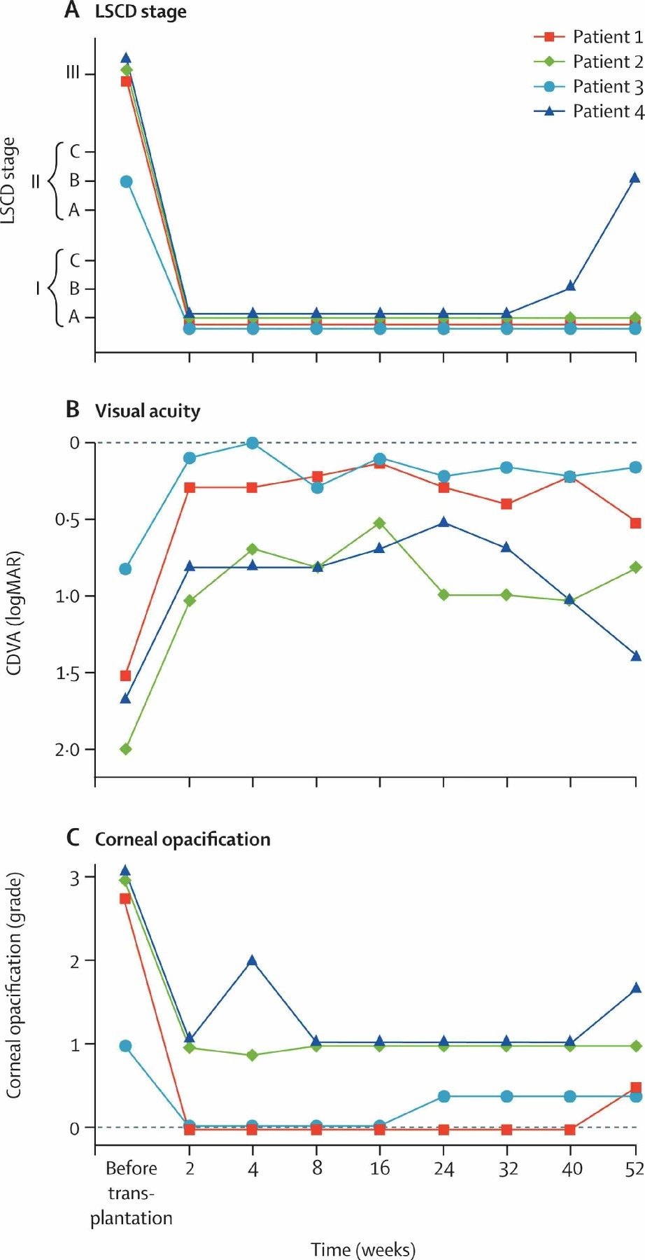 圖2:LSCD 分期、視力和角膜混濁 圖2:LSCD 分期、視力和角膜混濁